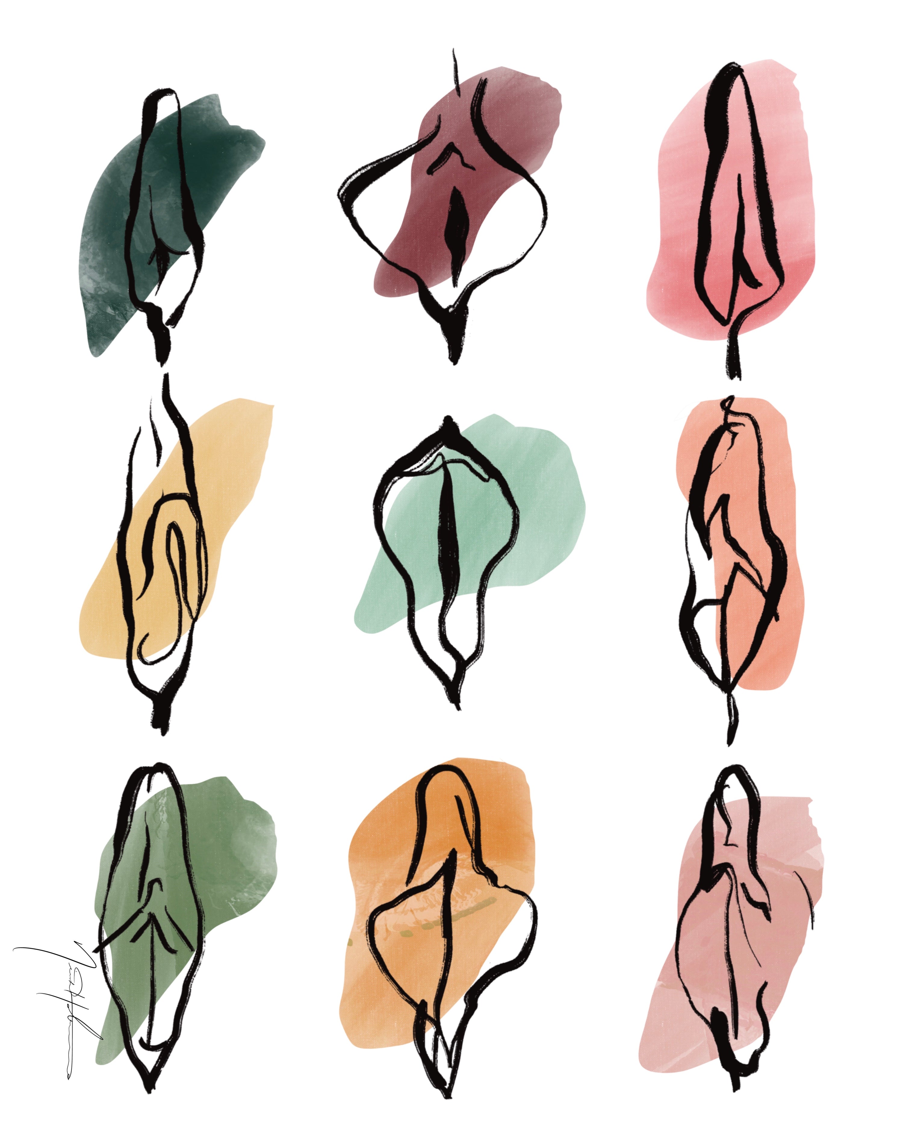 Vulvas